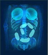 Xray Skeleton